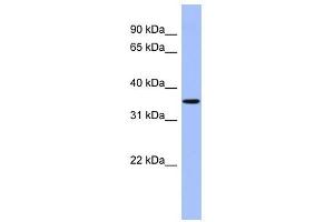 PPM1A antibody used at 1 ug/ml to detect target protein. (PPM1A 抗体)
