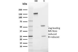 SDS-PAGE (SDS) image for anti-Solute Carrier Family 2 (Facilitated Glucose Transporter), Member 1 (SLC2A1) (AA 203-305) antibody (ABIN6940594)