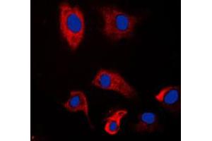 Immunofluorescence (IF) image for anti-Proteasome (Prosome, Macropain) 26S Subunit, Non-ATPase, 2 (PSMD2) (N-Term) antibody (ABIN7296736)