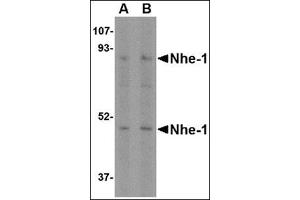 Western blot analysis of Nhe-1 in rat kidney tissue lysate with in with this product at (A) 1 and (B) 2 μg/ml. (SLC9A1 抗体  (C-Term, N-Term))