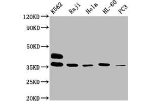 Western Blot Positive WB detected in: K562 whole cell lysate, Raji whole cell lysate, Hela whole cell lysate, HL60 whole cell lysate, PC-3 whole cell lysate All lanes: FCGR2A antibody at 1:2000 Secondary Goat polyclonal to rabbit IgG at 1/50000 dilution Predicted band size: 36, 35 kDa Observed band size: 36 kDa (FCGR2A 抗体  (AA 241-317))