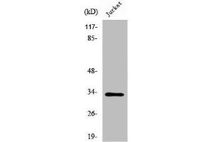 Western Blot analysis of Jurkat cells using UCP3 Polyclonal Antibody (UCP3 抗体  (C-Term))