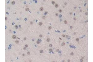 Immunohistochemistry (IHC) image for anti-Bone Morphogenetic Protein 15 (BMP15) (AA 269-391) antibody (ABIN7441844)