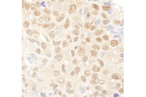 anti-Nuclear Transcription Factor Y, alpha (NFYA) (AA 320-333) antibody