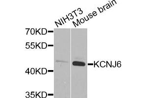 Western blot analysis of extracts of NIH3T3 and mouse brain cells, using KCNJ6 antibody. (KCNJ6 抗体)