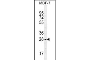 LGALS3 Antibody (C-term) (ABIN655879 and ABIN2845280) western blot analysis in MCF-7 cell line lysates (35 μg/lane). (Galectin 3 抗体  (C-Term))