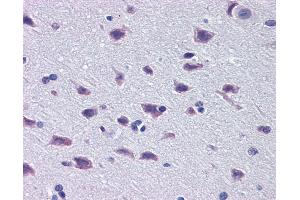 Immunohistochemistry (IHC) image for anti-Diencephalon/mesencephalon Homeobox 1 (DMBX1) (Middle Region) antibody (ABIN2780096) (DMBX1 抗体  (Middle Region))