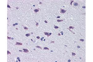 Immunohistochemistry (IHC) image for anti-Diencephalon/mesencephalon Homeobox 1 (DMBX1) (Middle Region) antibody (ABIN183501) (DMBX1 抗体  (Middle Region))