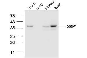 Lane 1: Mouse brain lysates Lane 2: Mouse lung Lane 3: Mouse Kidney Lane 4: Mouse Liver probed with Anti-SKP1 Polyclonal Antibody, Unconjugated  at 1:5000 for 90 min at 37˚C. (SKP1 抗体  (AA 81-163))
