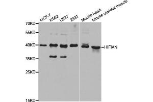 Western blot analysis of extracts of various cell lines, using HIF1AN antibody (ABIN5973179) at 1/1000 dilution. (HIF1AN 抗体)