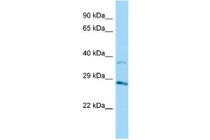 Host: Rabbit Target Name: AKR1B15 Sample Type: HT1080 Whole Cell lysates Antibody Dilution: 1. (AKR1B15 抗体  (C-Term))