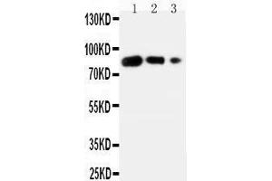 Western Blotting (WB) image for anti-CD80 (CD80) (AA 57-71), (N-Term) antibody (ABIN3042612) (CD80 抗体  (N-Term))
