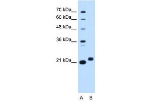 C1ORF159 antibody used at 0. (C1orf159 抗体  (Middle Region))