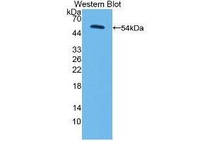 Detection of Recombinant PC, Human using Polyclonal Antibody to Pyruvate Carboxylase (PC) (PC 抗体  (AA 36-486))