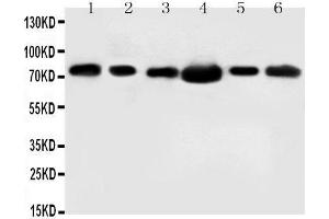 Anti-FAF1 antibody, Western blotting Lane 1: Rat Testis Tissue Lysate Lane 2: MM453 Cell Lysate Lane 3: MM231 Cell Lysate Lane 4: HELA Cell Lysate Lane 5: SMMC Cell Lysate Lane 6: SW620 Cell Lysate (FAF1 抗体  (N-Term))