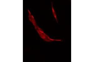 ABIN6278637 staining COLO205 by IF/ICC. (TAAR3 抗体)
