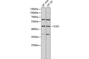 Western blot analysis of extracts of various cell lines, using TCN1 antibody (ABIN6132752, ABIN6148950, ABIN6148951 and ABIN6222050) at 1:1000 dilution. (TCN1 抗体  (AA 24-280))