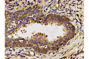 Immunohistochemistry (IHC) image for anti-Phosphoinositide 3 Kinase, p85 alpha (PI3K p85a) (pTyr607) antibody (ABIN6256775)