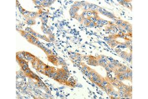 Immunohistochemistry (IHC) image for anti-Transient Receptor Potential Cation Channel, Subfamily A, Member 1 (TRPA1) antibody (ABIN2432369) (TRPA1 抗体)