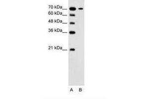 Image no. 1 for anti-Solute Carrier Family 5 (Low Affinity Glucose Cotransporter), Member 4 (SLC5A4) (N-Term) antibody (ABIN205017) (SLC5A4 抗体  (N-Term))