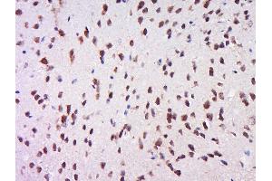 Paraformaldehyde-fixed, paraffin embedded rat brain, Antigen retrieval by boiling in sodium citrate buffer (pH6) for 15min, Block endogenous peroxidase by 3% hydrogen peroxide for 30 minutes, Blocking buffer (normal goat serum) at 37°C for 20min, Antibody incubation with Rabbit Anti-MSK1 (Ser212) Polyclonal Antibody, Unconjugated  at 1:500 overnight at 4°C, followed by a conjugated secondary for 90 minutes and DAB staining. (MSK1 抗体  (pSer212))