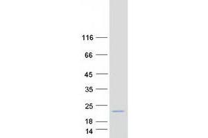 Western Blotting (WB) image for Cornichon Homolog 2 (CNIH2) protein (Myc-DYKDDDDK Tag) (ABIN2712505)