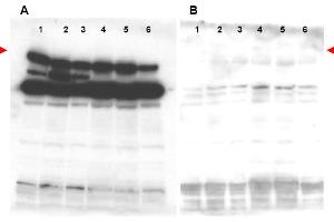Image no. 2 for anti-Pogo Transposable Element with ZNF Domain (POGZ) (N-Term) antibody (ABIN401435) (POGZ 抗体  (N-Term))