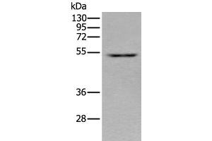 Western blot analysis of HEPG2 cell lysate using ZNF672 Polyclonal Antibody at dilution of 1:350 (ZNF672 抗体)