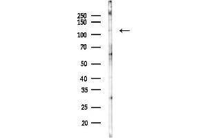 Western blot analysis of lysates from COLO205 cells(heat-shock,45 min treatment), using IPO5 Antibody at 1/1000 dilution.