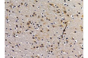 ABIN7094290 and ABIN7098337 at 1/100 staining mouse brain tissue by IHC-P. (HSPA13 抗体  (C-Term))