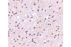 Immunohistochemical staining of human brain tissue with 5 ug/mL CADPS polyclonal antibody . (CADPS 抗体  (N-Term))