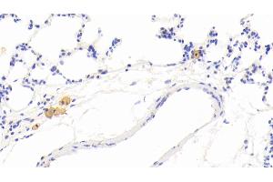 Detection of MMP12 in Rat Lung Tissue using Polyclonal Antibody to Matrix Metalloproteinase 12 (MMP12) (MMP12 抗体  (AA 372-463))