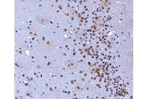 IHC analysis of HnRNP H/HNRNPH1 using anti-HnRNP H/HNRNPH1 antibody (ABIN4886623). (HNRNPH1 抗体  (N-Term))