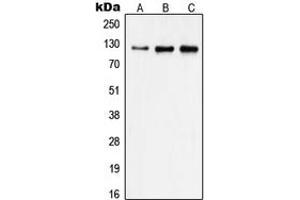 Western blot analysis of Focal Adhesion Kinase expression in A431 (A), HeLa (B), MDAMB231 (C) whole cell lysates. (FAK 抗体  (Center))
