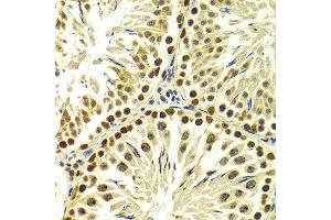 Immunohistochemistry (IHC) image for anti-Proline-, Glutamic Acid- and Leucine-Rich Protein 1 (PELP1) (AA 1021-1180) antibody (ABIN3023502)
