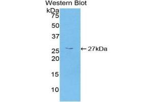 Detection of Recombinant CAMK2g, Human using Polyclonal Antibody to Calcium/Calmodulin Dependent Protein Kinase II Gamma (CAMK2g) (CAMKII gamma 抗体  (AA 6-208))
