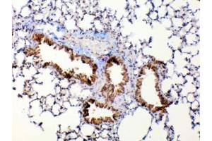 IHC testing of FFPE mouse lung tissue with Mmp13 antibody at 1ug/ml. (MMP13 抗体)