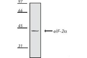 Western Blotting (WB) image for anti-Eukaryotic Translation Initiation Factor 2A, 65kDa (EIF2A) antibody (ABIN7211398) (EIF2A 抗体)