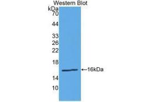 Western blot analysis of the recombinant protein. (Renin 抗体  (AA 67-179))