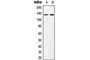 Western blot analysis of MN1 expression in K562 (A), NIH3T3 (B) whole cell lysates. (Meningioma 1 抗体  (Center))