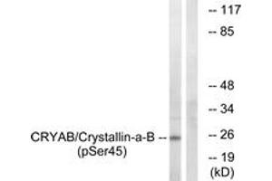Western blot analysis of extracts from COS7 cells treated with anisomycin 25ug/ml 30', using CRYAB (Phospho-Ser45) Antibody. (CRYAB 抗体  (pSer45))
