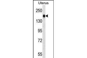 CGNL1 Antibody (N-term) (ABIN1539299 and ABIN2848602) western blot analysis in human normal Uterus tissue lysates (35 μg/lane). (CGNL1 抗体  (N-Term))
