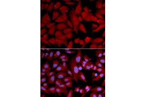 Immunofluorescence (IF) image for anti-Proteasome Subunit alpha 4 (PSMA4) (AA 1-261) antibody (ABIN3023325) (PSMA4 抗体  (AA 1-261))