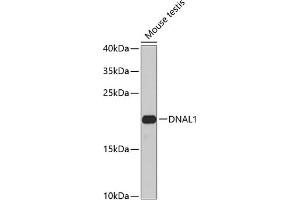 Western blot analysis of extracts of mouse testis, using DN antibody (ABIN6127820, ABIN6139729, ABIN6139731 and ABIN6224283) at 1:1000 dilution. (DNAL1 抗体  (AA 41-190))