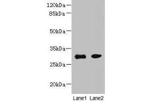 Western blot All lanes: PI4KAP1 antibody at 10 μg/mL Lane 1: Mouse gonadal tissue Lane 2: 293T whole cell lysate Secondary Goat polyclonal to rabbit IgG at 1/10000 dilution Predicted band size: 30 kDa Observed band size: 30 kDa (PI4KAP1 抗体  (AA 1-262))