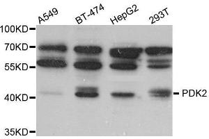 Western Blotting (WB) image for anti-Pyruvate Dehydrogenase Kinase, Isozyme 2 (PDK2) (AA 128-407) antibody (ABIN6220461) (PDK2 抗体  (AA 128-407))