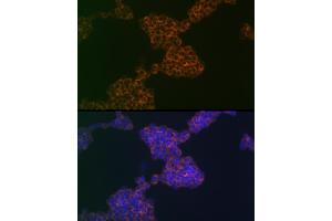 Immunofluorescence analysis of Jurkat cells using CD3G Rabbit mAb (ABIN1682574, ABIN3018517, ABIN3018518 and ABIN7101622) at dilution of 1:100 (40x lens). (CD3G 抗体)