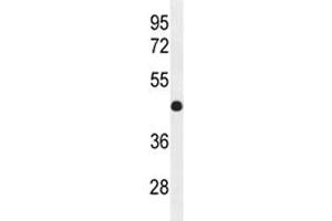 Western Blotting (WB) image for anti-Interferon Regulatory Factor 2 (IRF2) (AA 225-255) antibody (ABIN3031415)