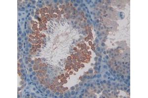 IHC-P analysis of Kidney tissue, with DAB staining. (CAMLG 抗体  (AA 1-187))