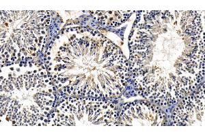 Detection of TBK1 in Mouse Testis Tissue using Polyclonal Antibody to TANK Binding Kinase 1 (TBK1) (TBK1 抗体  (AA 9-310))